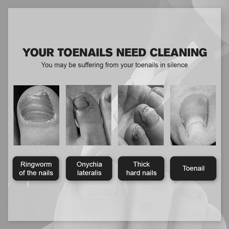 Last Day Promotion（50% OFF ）Medical-grade Nail Clippers - Libiyi
